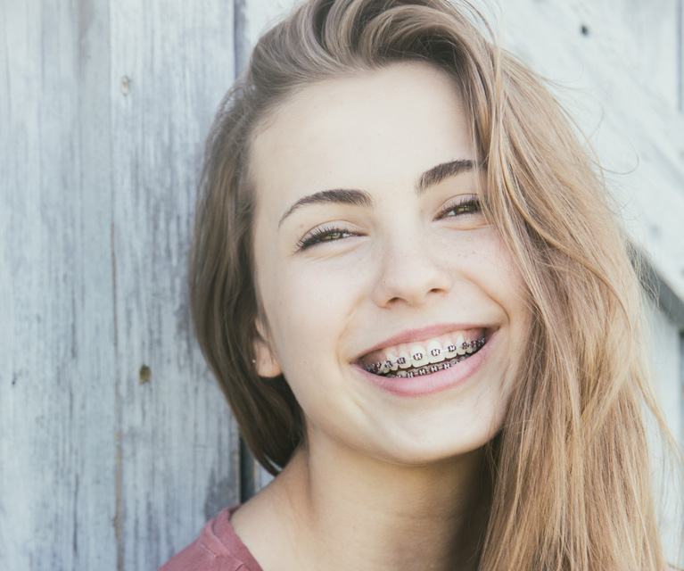 Types of braces for kids