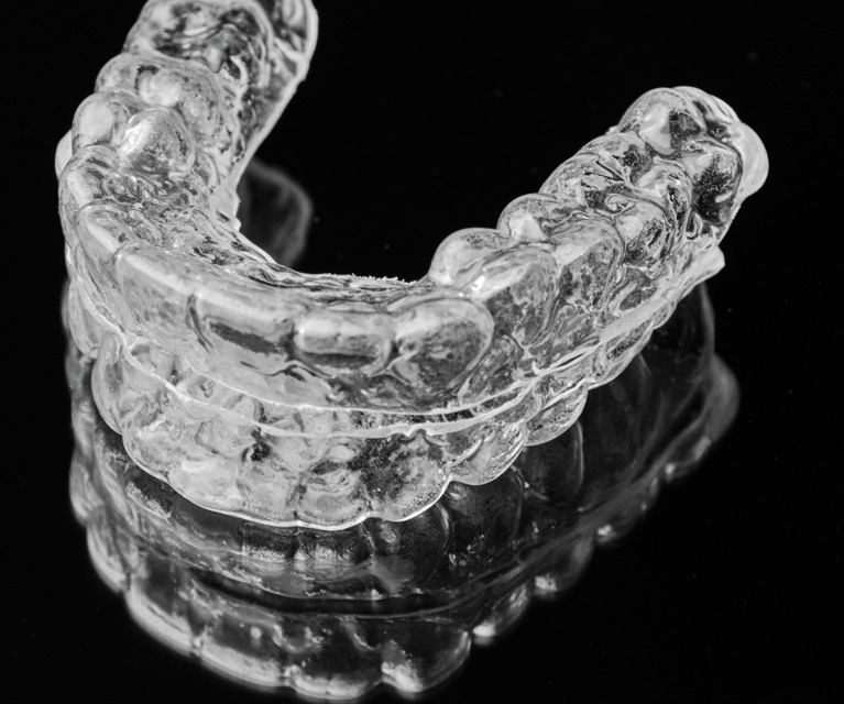 Why do I need a retainer?